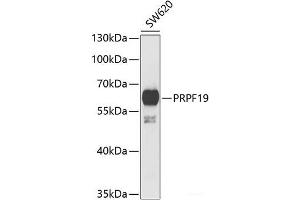Western blot analysis of extracts of SW620 cells using PRPF19 Polyclonal Antibody at dilution of 1:1000. (PRP19 anticorps)
