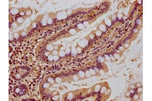 IHC image of ABIN7151082 diluted at 1:400 and staining in paraffin-embedded human small intestine tissue performed on a Leica BondTM system.