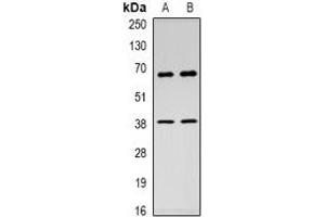 Western blot analysis of c-Rel expression in Hela (A), HEK293T (B) whole cell lysates. (c-Rel anticorps  (C-Term))