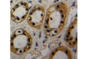 Used in DAB staining on fromalin fixed paraffin-embedded Kidney tissue (CAP1 anticorps  (AA 38-149))