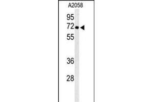 Western blot analysis of ATP6V1A Antibody (Center) (ABIN653735 and ABIN2843040) in  cell line lysates (35 μg/lane). (ATP6V1A anticorps  (AA 441-468))
