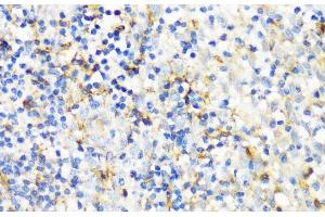 Immunohistochemistry of paraffin-embedded Human tonsil using ITGAX Polyclonal Antibody at dilution of 1:100 (40x lens). (CD11c anticorps)