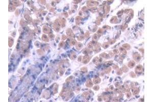 DAB staining on IHC-P; Samples: Rat Stomach Tissue