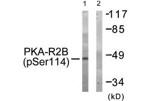 Western blot analysis of extracts from COS-7 cells treated with PMA using PKA-R2β (Phospho-Ser114) Antibody. (PRKAR2B anticorps  (pSer113))