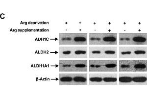 Arg supplementation activates ethanol degradation pathways in HepG2 cells. (ADH1C anticorps  (AA 1-375))