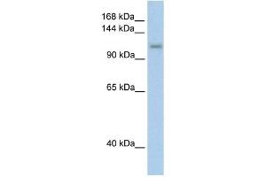WB Suggested Anti-PRPF6 Antibody Titration:  2. (PRP6/ANT-1 anticorps  (C-Term))