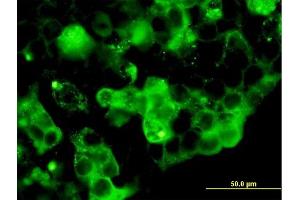 Immunofluorescence of purified MaxPab antibody to RETN on 293 cell. (Resistin anticorps  (AA 1-108))