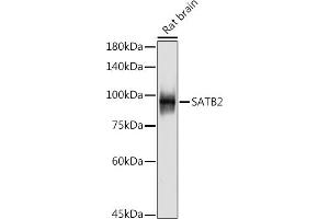 Western blot analysis of extracts of Rat brain, using S antibody (ABIN7270152) at 1:500 dilution. (SATB2 anticorps)