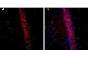 Expression of KCNQ2 in rat brain - Immunohistochemical staining of free-floating frozen rat hippocampal CA1 region sections using Guinea pig Anti-KCNQ2 Antibody (ABIN7043504, ABIN7045416 and ABIN7045417), (1:200). (KCNQ2 anticorps  (C-Term, Intracellular))