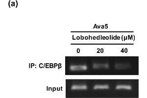 The reduction effect of lobohedleolide on C/EBPβ binding and expression, c-Jun phosphorylation, and JNK phosphorylation. (CEBPB anticorps  (N-Term))