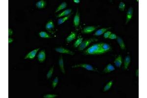 Immunofluorescence staining of Hela cells with ABIN7161406 at 1:166, counter-stained with DAPI. (PNPLA6 anticorps  (AA 345-493))