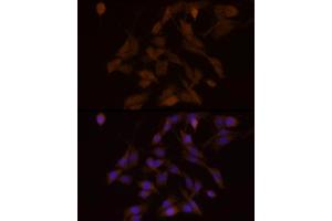 Immunofluorescence analysis of PC-12 cells using PFKFB3 Rabbit mAb (ABIN1680620, ABIN3018306, ABIN3018307 and ABIN7101590) at dilution of 1:100 (40x lens). (PFKFB3 anticorps)