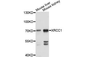 Western blot analysis of extracts of mouse liver and mouse kindney cells, using XRCC1 antibody. (XRCC1 anticorps)