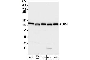 anti-Stromal Antigen 1 (STAG1) (AA 1150-1200) antibody