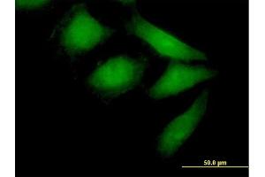 Immunofluorescence of purified MaxPab antibody to NEDD9 on HeLa cell.