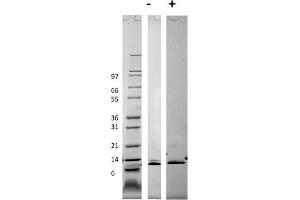 SDS-PAGE of Mouse Monocyte Chemotactic Protein-3 (CCL7) Recombinant Protein SDS-PAGE of Mouse Monocyte Chemotactic Protein-3 (CCL7) Recombinant Protein.