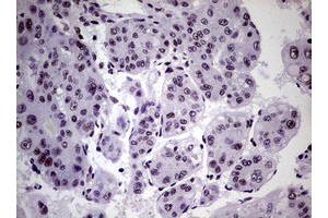 Image no. 8 for anti-Nibrin (NBN) (AA 183-460) antibody (ABIN1491066)