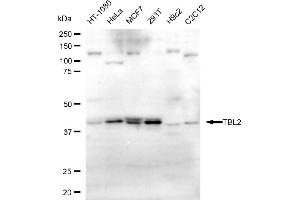 anti-Transducin (Beta)-Like 2 (TBL2) antibody