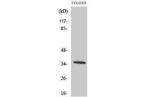 Western Blotting (WB) image for anti-Olfactory Receptor, Family 52, Subfamily D, Member 1 (OR52D1) (C-Term) antibody (ABIN3186129) (OR52D1 anticorps  (C-Term))