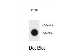 Dot blot analysis of CCNB2 Antibody (Phospho S10) Phospho-specific Pab (ABIN1881156 and ABIN2839948) on nitrocellulose membrane.