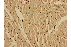 Immunohistochemistry of paraffin-embedded human heart tissue using ABIN7157046 at dilution of 1:100