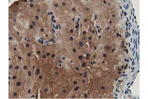 Image no. 6 for anti-Glutathione S-Transferase theta 2 (GSTT2) antibody (ABIN1498554)