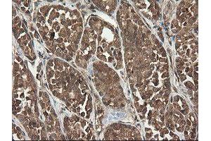 Image no. 6 for anti-Ubiquitin-Conjugating Enzyme E2G 2 (UBE2G2) antibody (ABIN1501634)