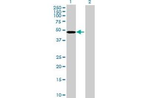 Western Blot analysis of ARMC6 expression in transfected 293T cell line by ARMC6 MaxPab polyclonal antibody. (ARMC6 anticorps  (AA 1-476))