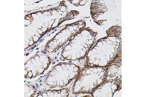 Immunohistochemistry of paraffin-embedded human stomach using MMP9 antibody (ABIN4904400) at dilution of 1:100 (40x lens). (MMP 9 anticorps)