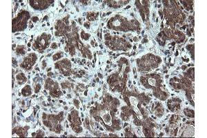 Image no. 4 for anti-serine/threonine Kinase 38 Like (STK38L) (AA 1-281) antibody (ABIN1490699)