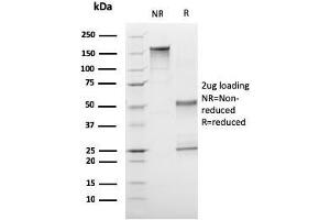 SDS-PAGE Analysis Purified CD1a Mouse Monoclonal Antibody (C1A/3249). (CD1a anticorps  (AA 43-173))