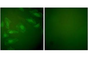 Immunofluorescence analysis of HeLa cells, using DJ-1 Antibody.