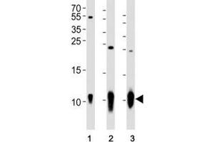 Western blot analysis of lysate from (1) A431 cell line, (2) mouse brain and (3) rat brain tissue using S100B antibody at 1:1000. (S100B anticorps)