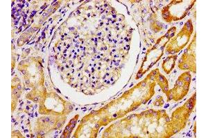 Immunohistochemistry of paraffin-embedded human kidney tissue using ABIN7142689 at dilution of 1:100 (MPP1 anticorps  (AA 123-252))
