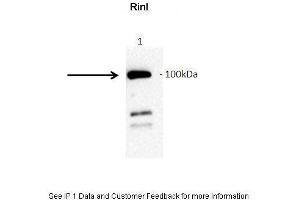 anti-Ras and Rab Interactor-Like (RINL) (N-Term) antibody