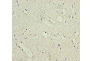 Immunohistochemistry of paraffin-embedded human brain tissue using ABIN7164067 at dilution of 1:100 (POU4F3 anticorps  (AA 1-180))