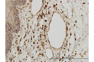 Immunoperoxidase of monoclonal antibody to B2M on formalin-fixed paraffin-embedded human esophagus.