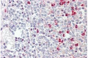 Human Spleen: Formalin-Fixed, Paraffin-Embedded (FFPE)