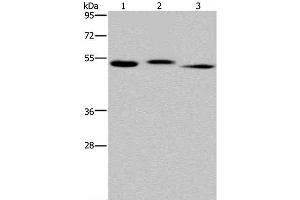 Western Blot analysis of Human kidney tissue, HepG2 cell and Human testis tissue using HYAL3 Polyclonal Antibody at dilution of 1:400 (HYAL3 anticorps)