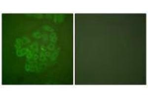 Immunofluorescence analysis of A549 cells, using GR (Ab-211) antibody. (Glucocorticoid Receptor anticorps  (Ser211))
