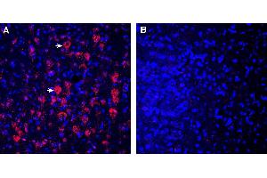 Expression of CD157 in rat parietal cortex. (BST1 anticorps  (Extracellular))