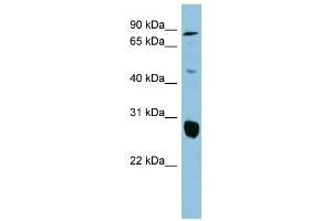 WB Suggested Anti-SLC26A4 Antibody Titration:  0. (SLC26A4 anticorps  (Middle Region))