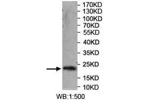 Western blot analysis of recombinant protein using SYT14 Antibody. (SYT14 anticorps  (AA 272-459))