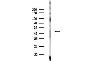 Western blot analysis of lysates from MCF7 cells(heat-shock,45 min treatment), using Serpin  Antibody at 1/1000 dilution.