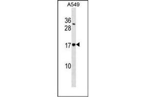 Western blot analysis of SSR4 / TRAPD Antibody  in A549 cell line lysates (35ug/lane). (SSR4 anticorps  (Middle Region))