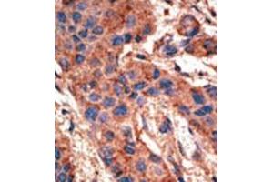 Image no. 2 for anti-Bone Morphogenetic Protein Receptor 1A (BMPR1A) (AA 39-69), (N-Term) antibody (ABIN357372) (BMPR1A anticorps  (N-Term))
