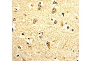 IHC analysis of FFPE human brain stained with SOX4 antibody