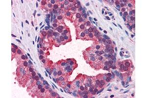 Anti-KEAP1 antibody IHC of human prostate. (KEAP1 anticorps  (AA 21-70))