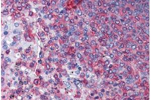 Human Spleen: Formalin-Fixed, Paraffin-Embedded (FFPE)