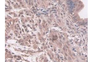 Detection of NAT1 in Mouse Uterus Tissue using Polyclonal Antibody to N-Acetyltransferase 1 (NAT1)